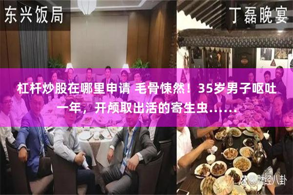 杠杆炒股在哪里申请 毛骨悚然！35岁男子呕吐一年，开颅取出活的寄生虫……